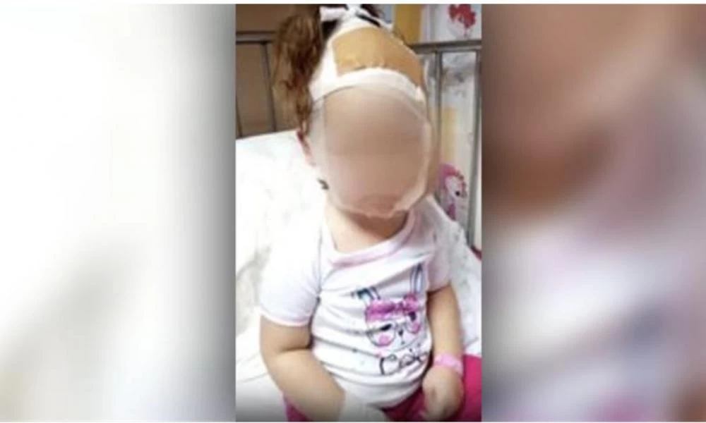 Επίθεση σκύλων σε κοριτσάκι: Έκκληση μάνας να βρεθεί ο ιδιοκτήτης τους